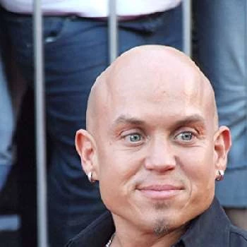 Martin Klebba Biography