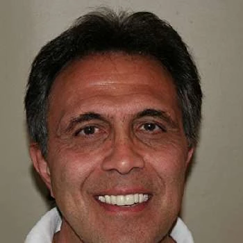 Nick Abdo Biography