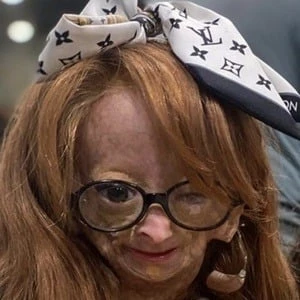 Adalia Rose Biography